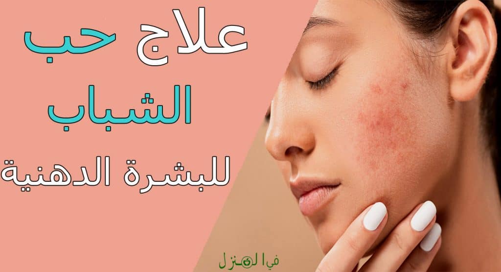 علاج حب الشباب للبشرة الدهنية